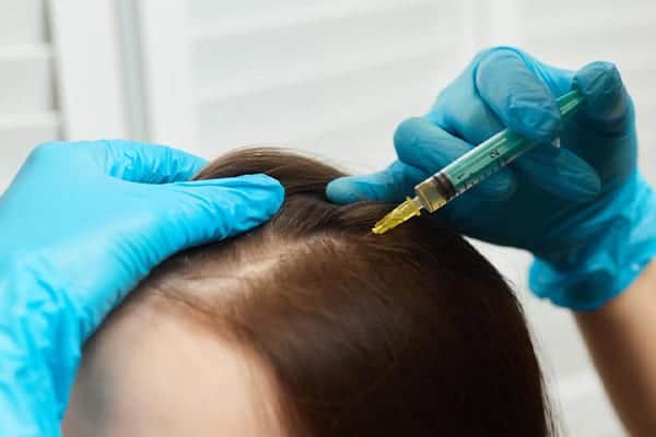 injection prp cheveux clinique implants greffe de cheveux implant capillaire the clinic bruxelles