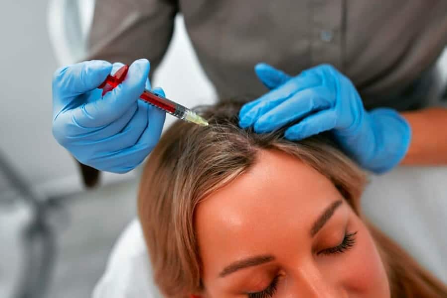 injection prp cheveux the clinic bruxelles expert implant traitement capillaire greffe de cheveux medecine esthetique belgique