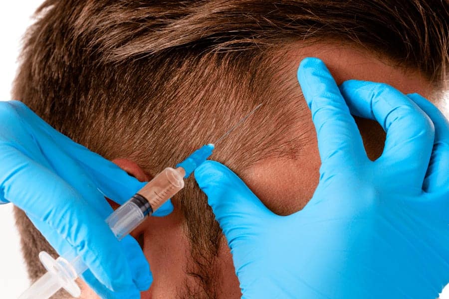 injection prp magellan prix belgique the clinic bruxelles expert implant traitement capillaire greffe de cheveux medecine esthetique belgique