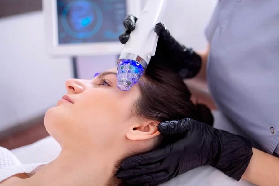 microneedling resultat au bout de combien de temps the clinic bruxelles expert implant traitement capillaire greffe de cheveux medecine esthetique belgique