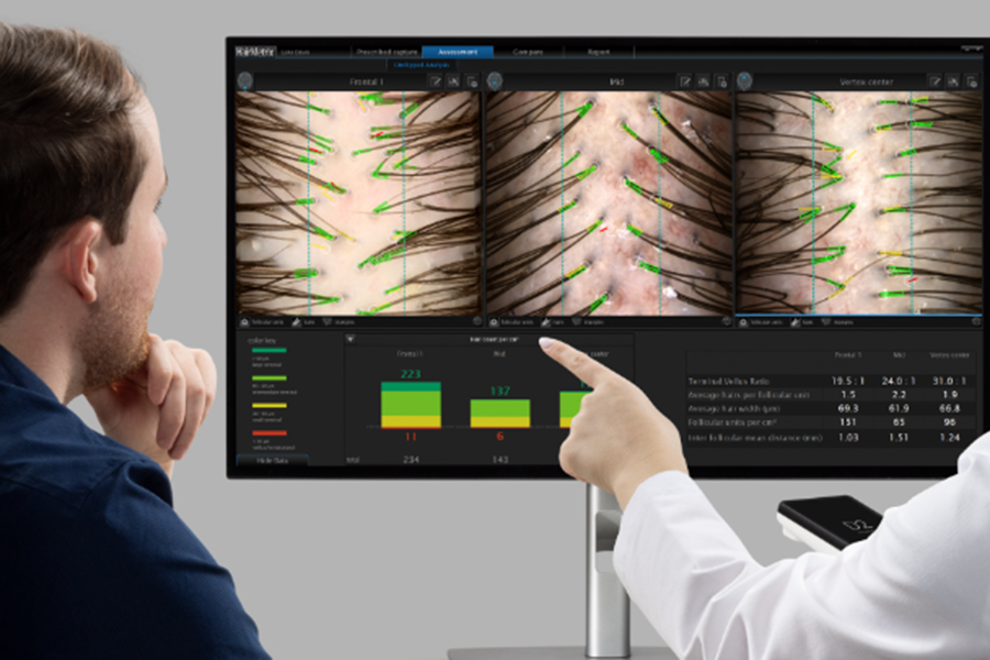 consultation hairmetrix the clinic bruxelles analyse perte cheveux