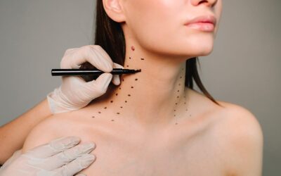 Qu’est-ce que le Nefertiti lift botox ?