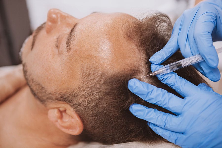 prp magellan cheveux the clinic bruxelles clinique greffe cheveux