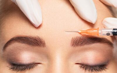 Le Botox par zone, tout savoir